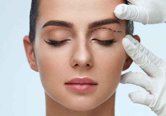 Exploring Upper Blepharoplasty: Comprehensive Guide to Upper Eyelid Surgery in Turkey