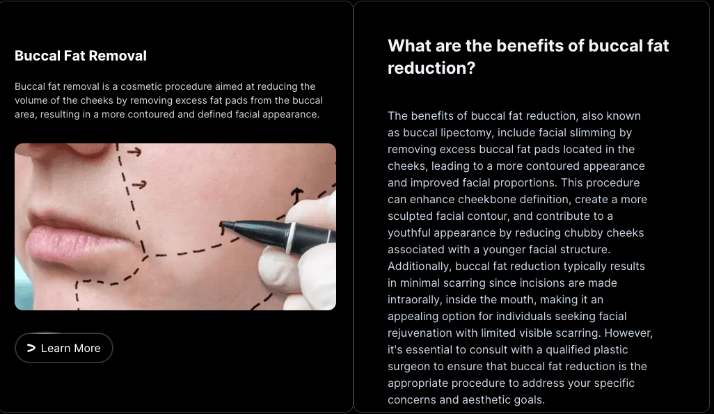 Buccal Fat Removal