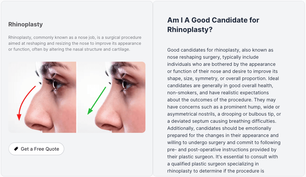 Rhinoplasty